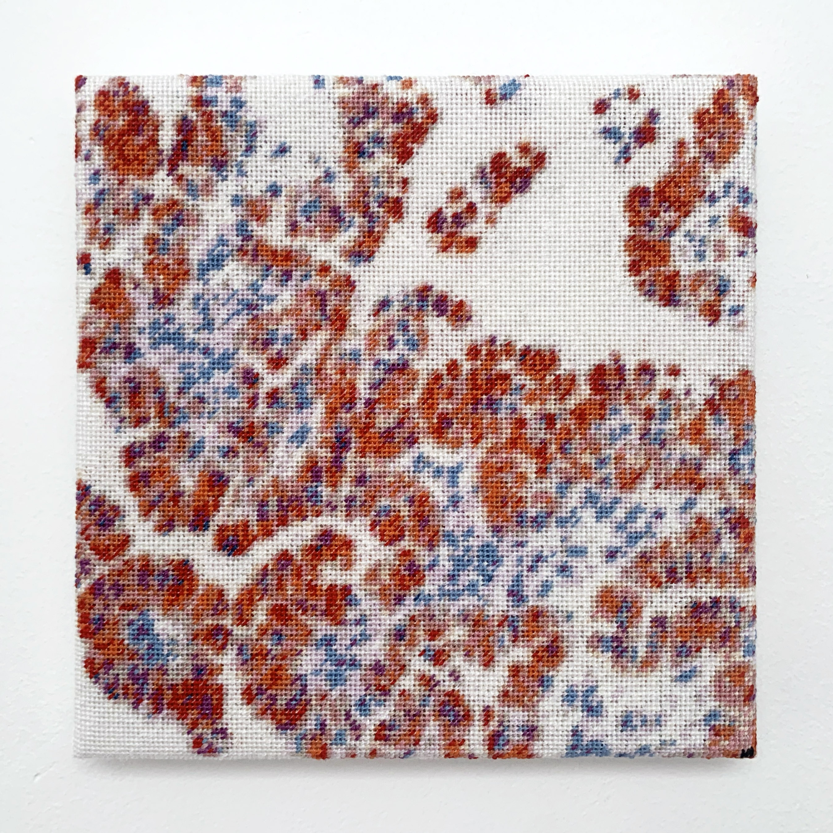  / Embroidered representation of an Immunohistochemical staining for mitochondrial protein MU213-UC showing abundant cytoplasmic mitochondria, consistent with an oncocytoma of the lacrimal gland. Art by artist Marine Beaufils.